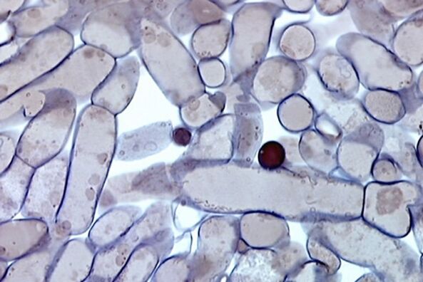 iltze onddoen zelulak mikroskopioan