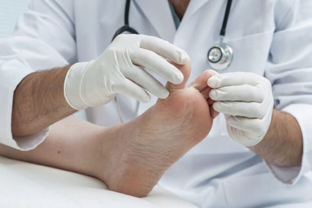 oinetako onddoaren diagnostikoa medikuak