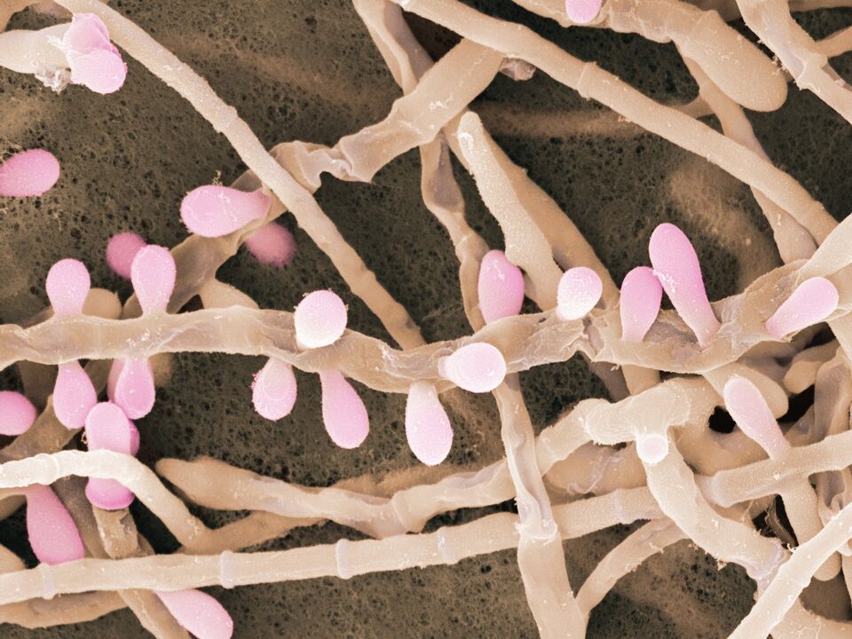 Trichophyton rubrum oinen azala eragiten duen onddo mota bat da.